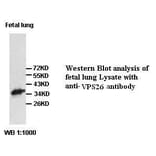 VPS26 Antibody from Signalway Antibody (39420) - Antibodies.com