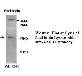 A2LD1 Antibody from Signalway Antibody (39426) - Antibodies.com