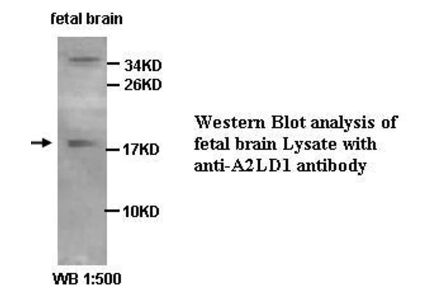 A2LD1 Antibody from Signalway Antibody (39426) - Antibodies.com