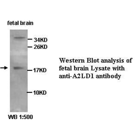 A2LD1 Antibody from Signalway Antibody (39426) - Antibodies.com
