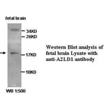A2LD1 Antibody from Signalway Antibody (39426) - Antibodies.com
