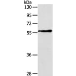 OLFM4 Antibody from Signalway Antibody (40062) - Antibodies.com