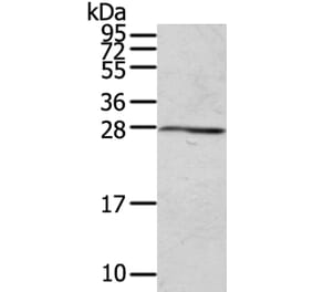 RAB20 Antibody from Signalway Antibody (40068) - Antibodies.com