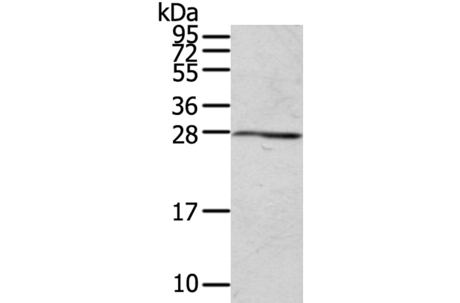 RAB20 Antibody from Signalway Antibody (40068) - Antibodies.com