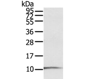 S100P Antibody from Signalway Antibody (40089) - Antibodies.com