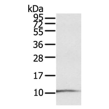 S100P Antibody from Signalway Antibody (40089) - Antibodies.com