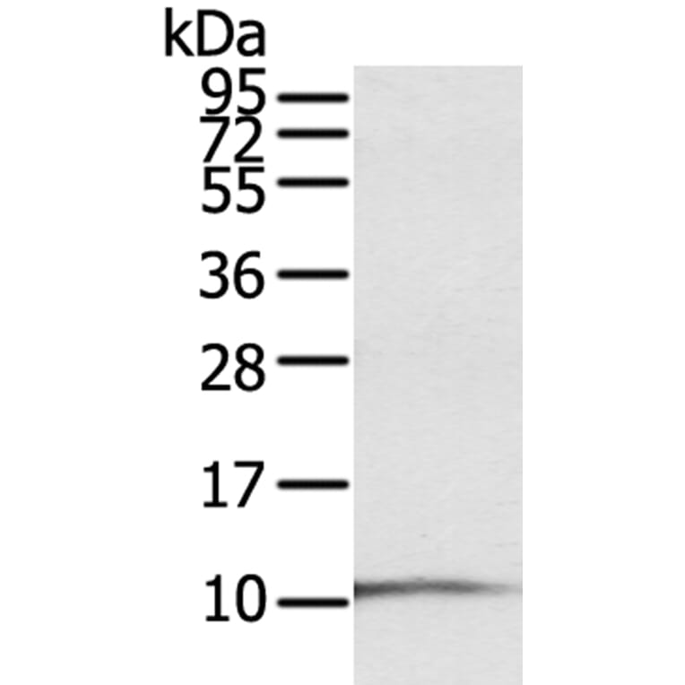 S100P Antibody from Signalway Antibody (40089) - Antibodies.com