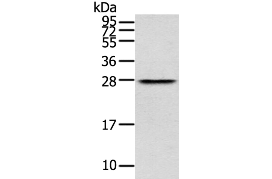 THYN1 Antibody from Signalway Antibody (40147) - Antibodies.com