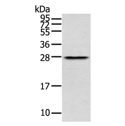 THYN1 Antibody from Signalway Antibody (40147) - Antibodies.com