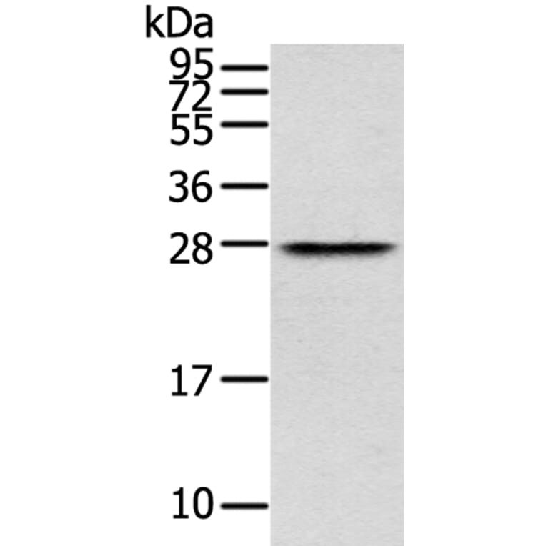 THYN1 Antibody from Signalway Antibody (40147) - Antibodies.com