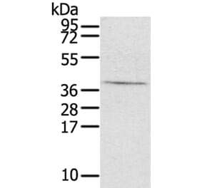 EFNB3 Antibody from Signalway Antibody (40179) - Antibodies.com