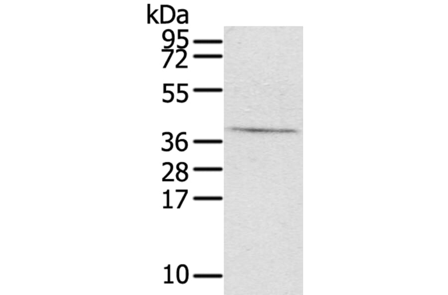 EFNB3 Antibody from Signalway Antibody (40179) - Antibodies.com