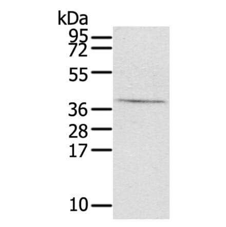 EFNB3 Antibody from Signalway Antibody (40179) - Antibodies.com