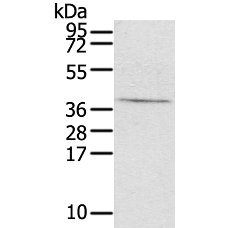 EFNB3 Antibody from Signalway Antibody (40179) - Antibodies.com