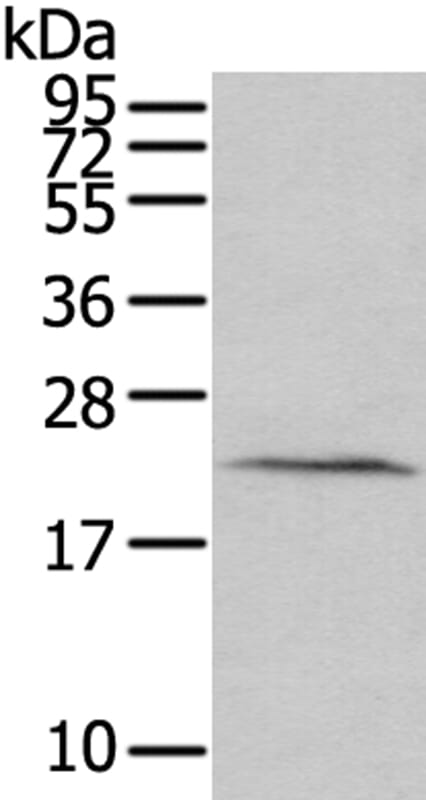 Gel: 12% SDS-PAGE Lysate: 40ug Human prostate tissue. Primary antibody: 1/200 dilution Secondary antibody dilution: 1/8000Exposure time: 2 minutes