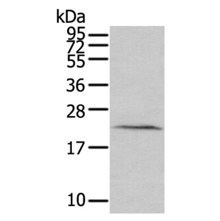 HINT3 Antibody from Signalway Antibody (40182) - Antibodies.com