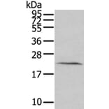 HINT3 Antibody from Signalway Antibody (40182) - Antibodies.com