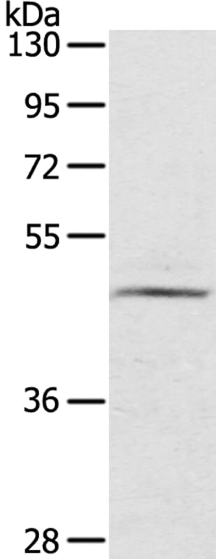 Gel: 8% SDS-PAGE Lysate: 40ug TM4 cell. Primary antibody: 1/200 dilution Secondary antibody dilution: 1/8000Exposure time: 3 minutes