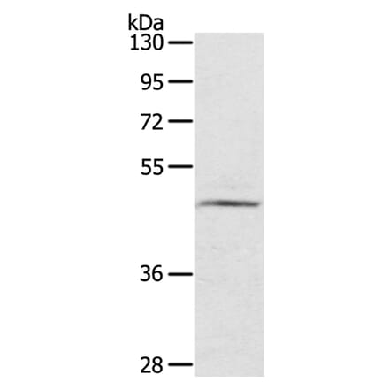 CERS3 Antibody from Signalway Antibody (40197) - Antibodies.com