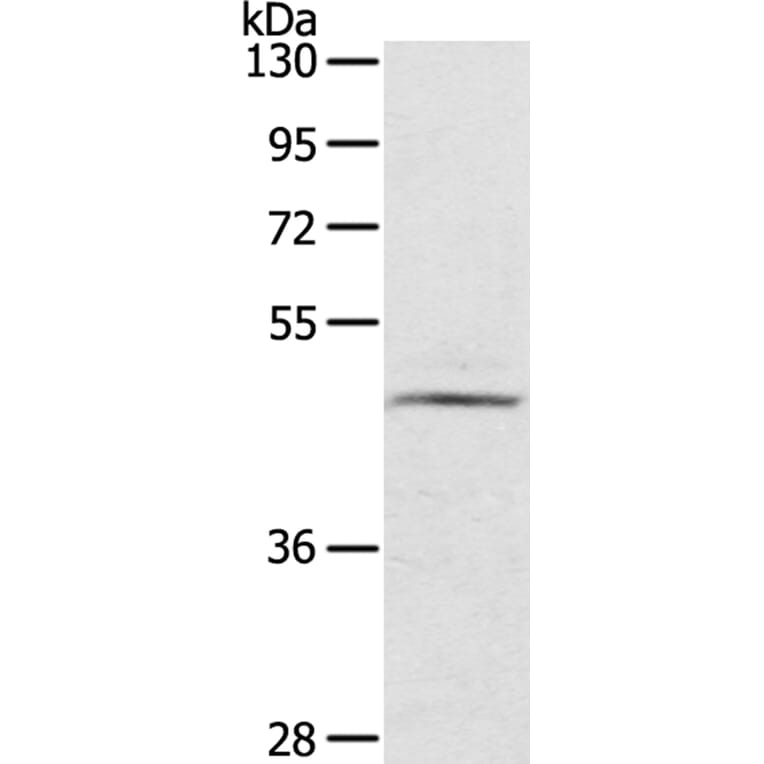 CERS3 Antibody from Signalway Antibody (40197) - Antibodies.com