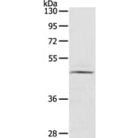 CERS3 Antibody from Signalway Antibody (40197) - Antibodies.com