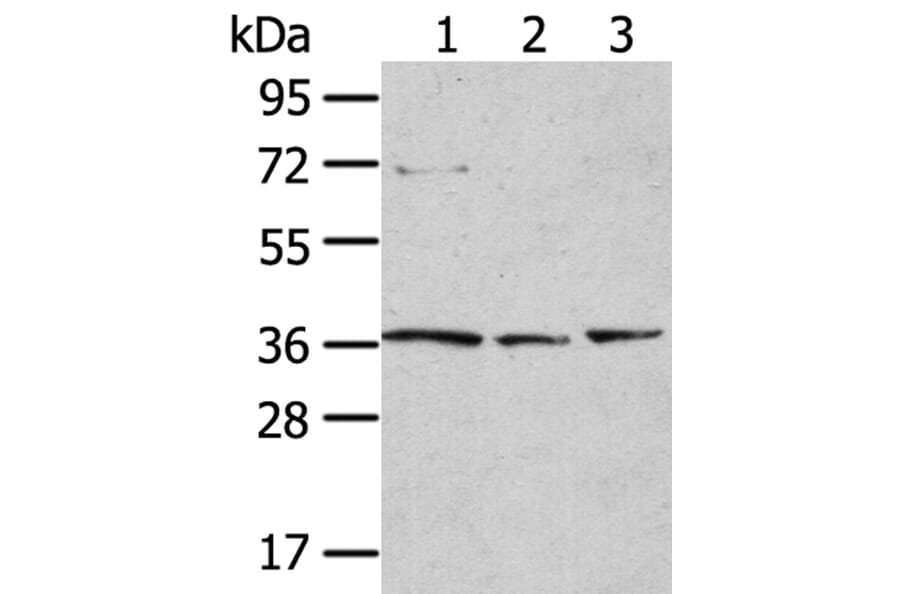 TPST1 Antibody from Signalway Antibody (40262) - Antibodies.com