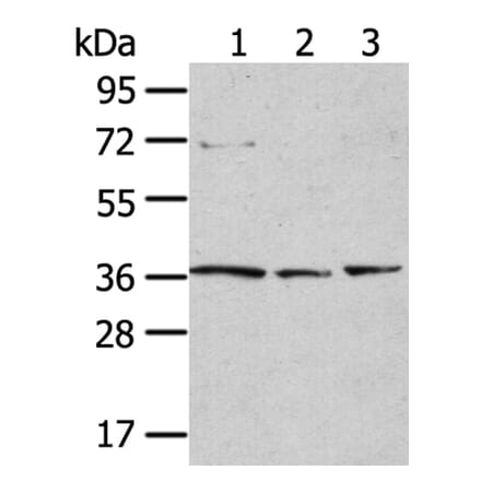 TPST1 Antibody from Signalway Antibody (40262) - Antibodies.com