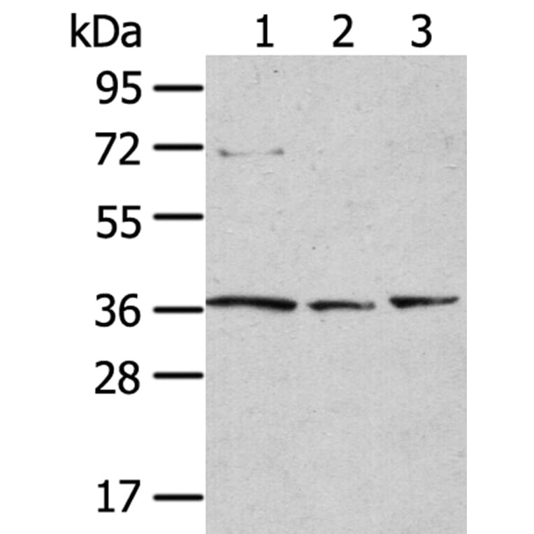 TPST1 Antibody from Signalway Antibody (40262) - Antibodies.com