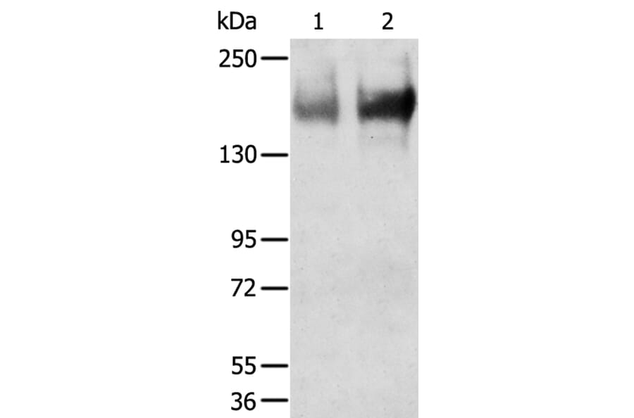 TRPM6 Antibody from Signalway Antibody (40267) - Antibodies.com