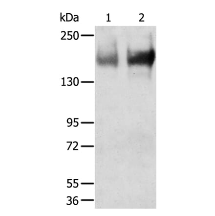 TRPM6 Antibody from Signalway Antibody (40267) - Antibodies.com