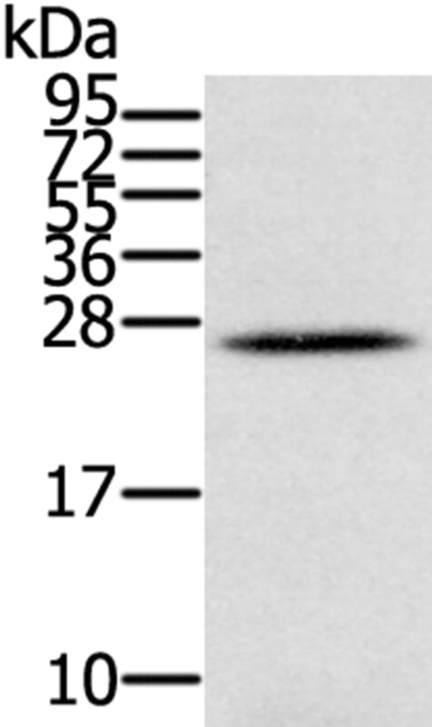 Gel: 12% SDS-PAGE Lysate: 40ug Human ovarian cancer. Primary antibody: 1/350 dilution Secondary antibody dilution: 1/8000Exposure time: 1 minute