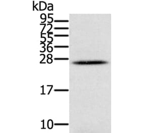 IFNL3 Antibody from Signalway Antibody (40311) - Antibodies.com