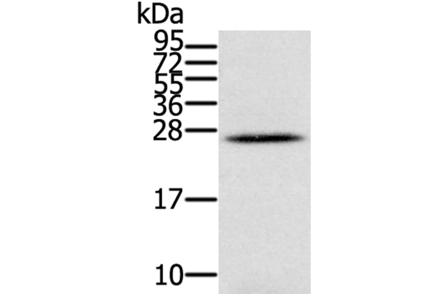 IFNL3 Antibody from Signalway Antibody (40311) - Antibodies.com
