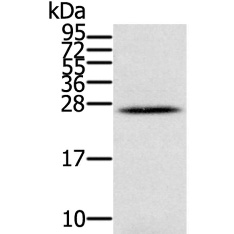 IFNL3 Antibody from Signalway Antibody (40311) - Antibodies.com