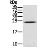 IFNL3 Antibody from Signalway Antibody (40311) - Antibodies.com
