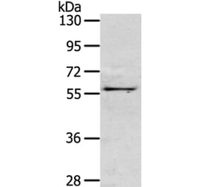 OLFM3 Antibody from Signalway Antibody (40315) - Antibodies.com