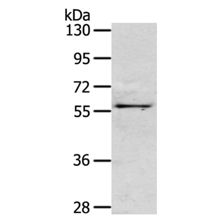 OLFM3 Antibody from Signalway Antibody (40315) - Antibodies.com