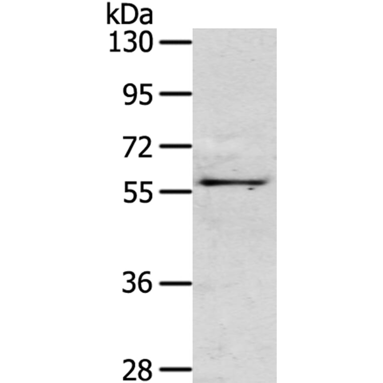 OLFM3 Antibody from Signalway Antibody (40315) - Antibodies.com