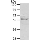 OLFM3 Antibody from Signalway Antibody (40315) - Antibodies.com