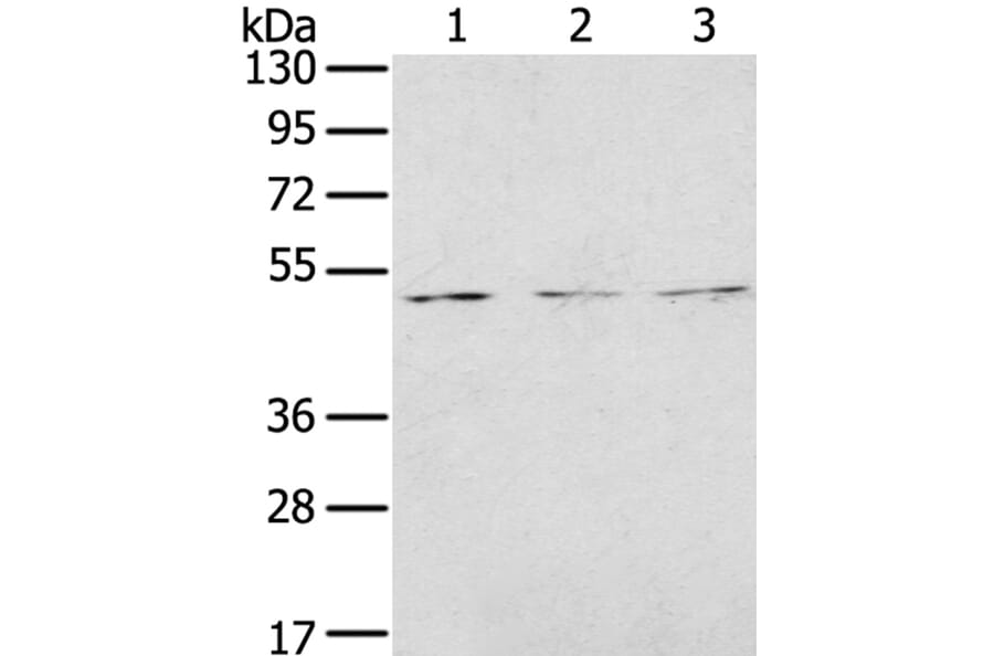 FOXG1 Antibody from Signalway Antibody (40353) - Antibodies.com