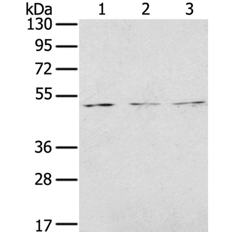 FOXG1 Antibody from Signalway Antibody (40353) - Antibodies.com