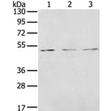 FOXG1 Antibody from Signalway Antibody (40353) - Antibodies.com