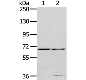 MMP24 Antibody from Signalway Antibody (40354) - Antibodies.com