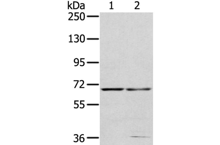 MMP24 Antibody from Signalway Antibody (40354) - Antibodies.com