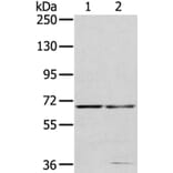 MMP24 Antibody from Signalway Antibody (40354) - Antibodies.com