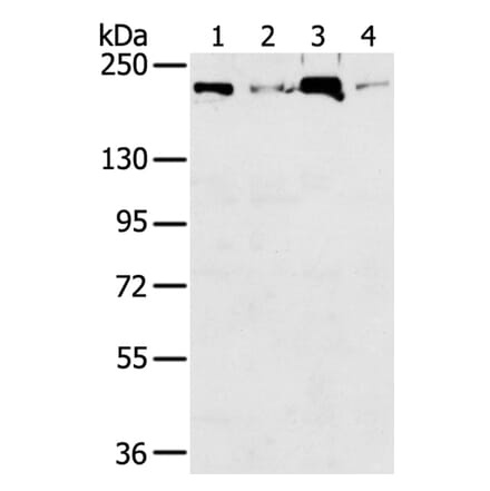 TOP2B Antibody from Signalway Antibody (40387) - Antibodies.com