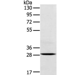 TREM2 Antibody from Signalway Antibody (40390) - Antibodies.com