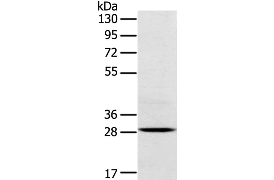 TREM2 Antibody from Signalway Antibody (40390) - Antibodies.com