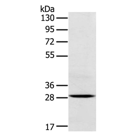TREM2 Antibody from Signalway Antibody (40390) - Antibodies.com