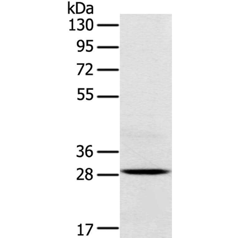TREM2 Antibody from Signalway Antibody (40390) - Antibodies.com